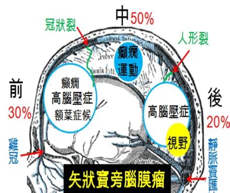 大腦簾 雄穴中出21